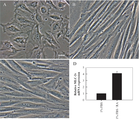 Retinoic acid induces differentiation of embryonic H9c2 myoblasts to cardiomyocytes in low serum supplemented with retinoic acid. Rat embryonic heart-derived myoblasts maintained in DMEM containing 10% FBS (A) were cultured in DMEM containing 1% FBS for seven days resulting in differentiation to skeletal muscle (B). A seven day culture in low serum media supplemented with 10 nM retinoic acid resulted in differentiation into cardiac myocytes (C). RT-PCR quantitation of MLC-2v transcripts (which display absolute cardiac tissue specificity) indicates overexpression of the gene in retinoic acid treated cells compared to cells cultured in low serum without retinoic acid (mean ± standard deviations of triplicates from a representative experiment, total of three independent experiments, (D). Bar = 5 μm; x 20 magnification.