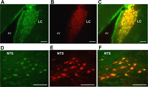 Dual immunofluorescence histochemistry for nesfatin-1 and tyrosine hydroxylase (TH)