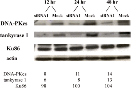 Tankyrase 1 depletion rapidly reduces DNA-PKcs protein levels, while Ku86 levels remain unchanged