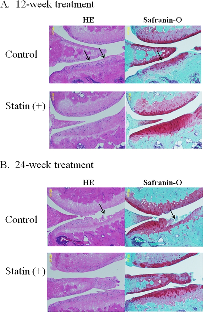 Representative images of cartilage degeneration in OA model mouse