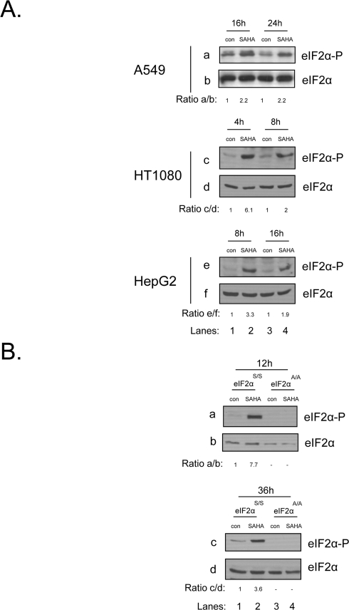 eIF2αphosphorylation is induced in human cancer and mouse cells upon treatment with vorinostat