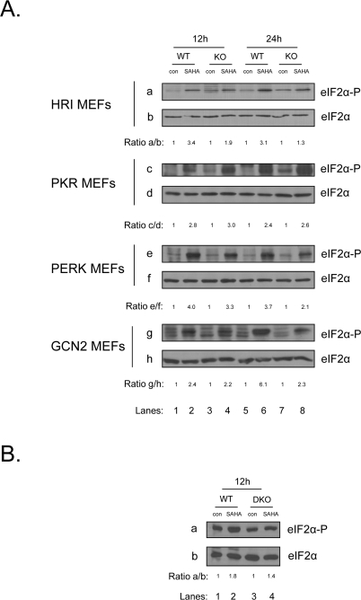 Multiple eIF2α kinases are responsible for the induction of eIF2α phosphorylation upon treatment with vorinostat