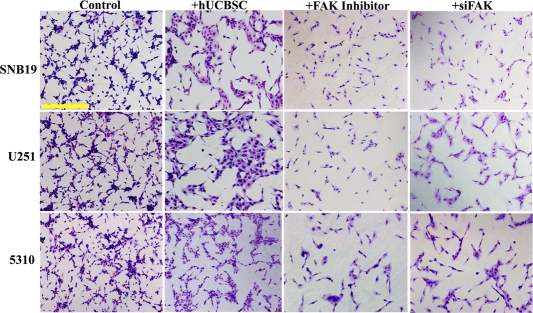 Inhibition of vessel formation by hUCBSC treatment