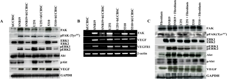 Downregulation of angiogenesis related proteins by hUCBSC