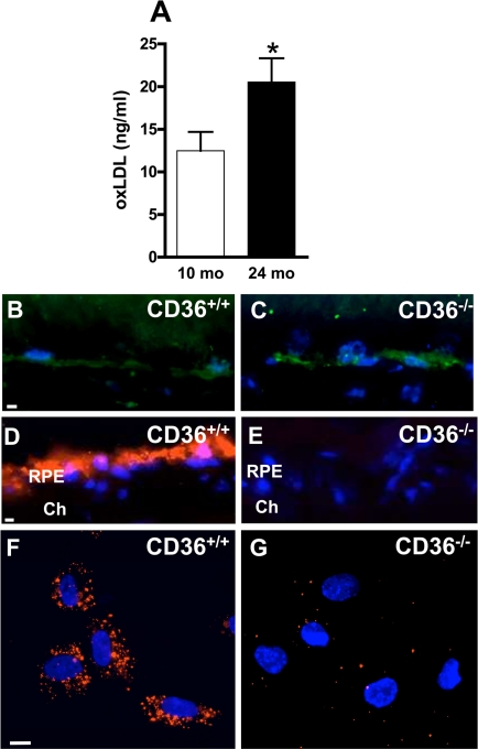 CD36 deficiency inhibits oxLDL uptake by RPE cells and leads to oxLDL accumulation