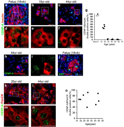 CENP-A protein expression declines with age in human islet cells, but not in exocrine cells