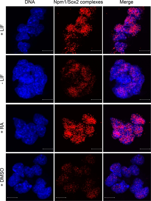 Npm1/Sox2 interaction changes during differentiation