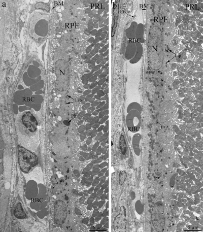 Outer retina of Wistar (a) and OXYS (b) rats at the age of 3 months. PRL – photoreceptors, RPE – retinal pigment epithelial cell, N – RPE nucleus, m – mitochondrion, Ph – phagosome, Lip – lipofuscin material, BM – Bruch's membrane, Endo – endothelial cell, RBC – red blood cell.