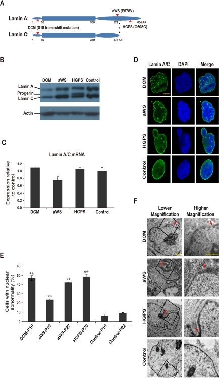 iPSCs from fibroblasts with 3 different mutations in lamin A/C