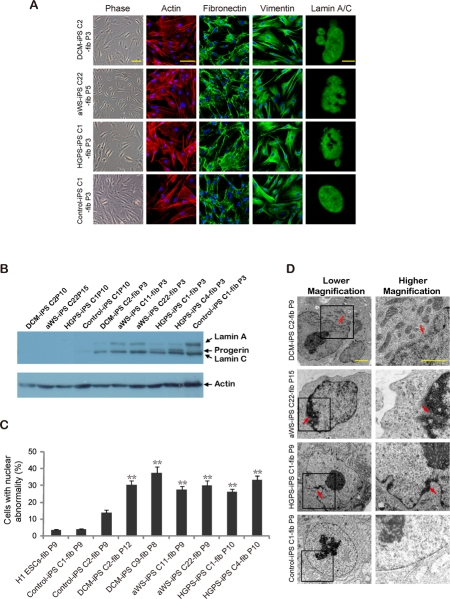 Nuclear abnormalities are restored in iPSC-derived fibroblasts containing mutations in lamin A/C