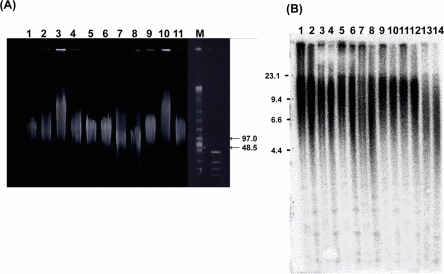 Genofield gel electrophoresis of genomic DNA and Southern blot analysis of samples from WS patients