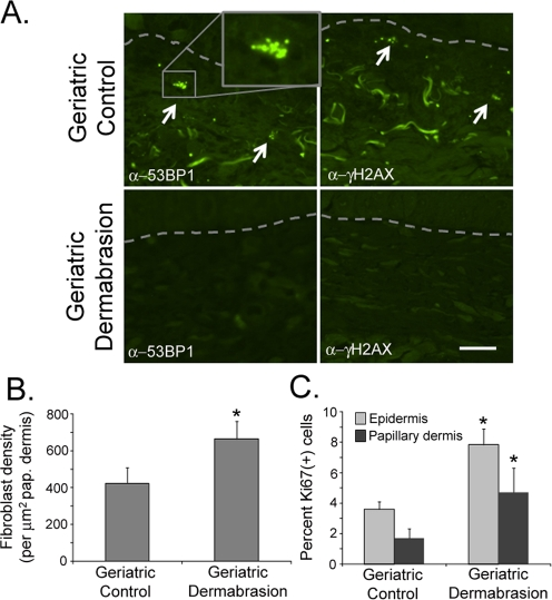 Dermabrasion stimulates fibroblast replication and suppresses senescence in geriatric dermis