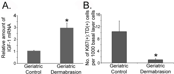 Dermabrasion upregulates IGF-1 expression and restores the appropriate UVB response to geriatric skin
