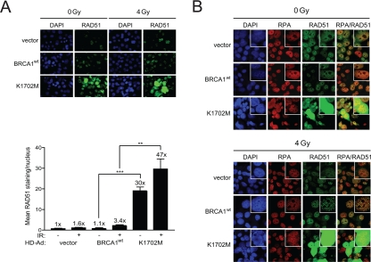 K1702M increases RAD51 foci and nuclear immuno-staining that co-localizes with RPA in irradiated HCC1937 cells