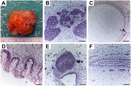 Teratoma formation provides an in vivo assay of hESCs differentiation capacity