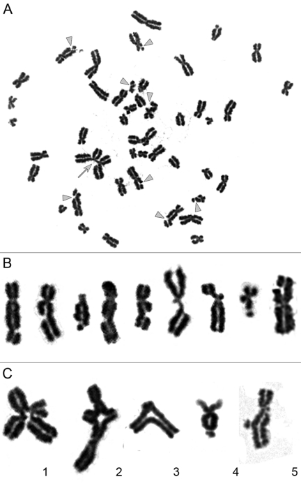 Chromatid-type aberrations observed in metaphases 2 hours after exposure to γ-irradiation