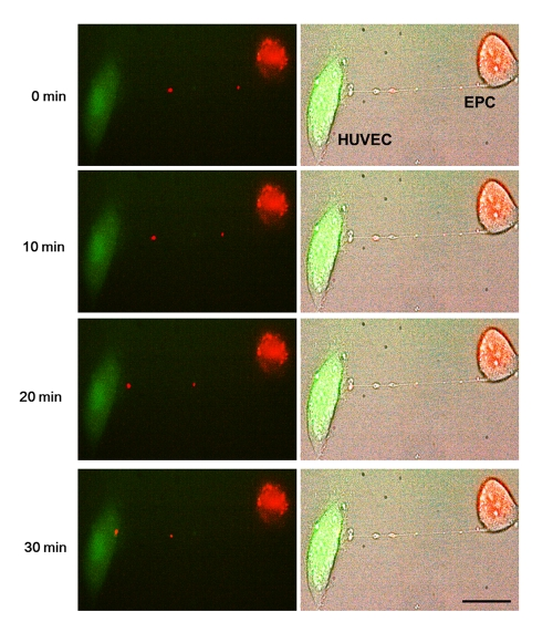 Representative time-lapse sequence of images illustrating a rapid transfer of lysosomes from an EPC to a stressed HUVEC