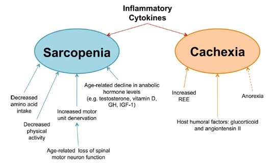 Underlying mechanisms involved in muscle wasting diseases