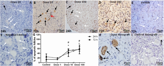 Induction of apoptotic primordial follicle death by doxorubicin