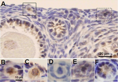 Induction of DSBs and apoptotic follicle death by doxorubicin in xenografted SCID mouse ovaries