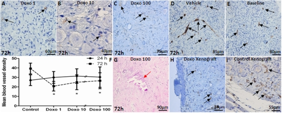 The impact of doxorubicin on vascular density in ovarian cortical pieces