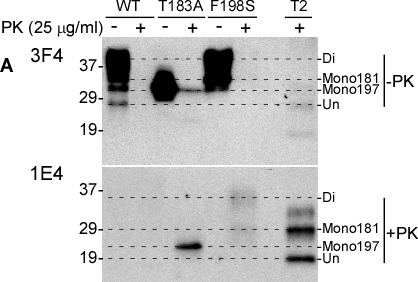 Detection of untreated and PK-treated PrP from three types of cultured cells with 3F4 and 1E4