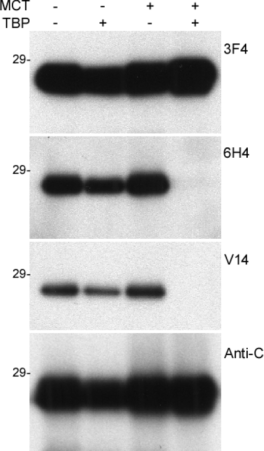 Western blotting of PrP with V14 and V61