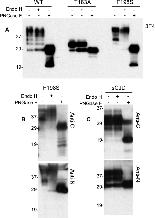 Western blotting of the recombinant human PrP untreated or treated with MCT or/and TBP probed with various anti-PrP antibodies