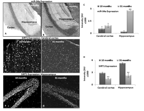 Expression of miRNA-34a and SIRT1 in brain tissue sections from middle and old age C57/B6 mice