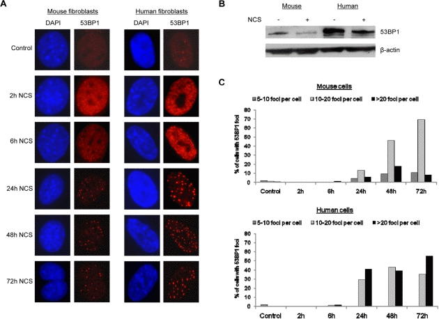 Human cells contain more 53BP1 foci following DNA damage