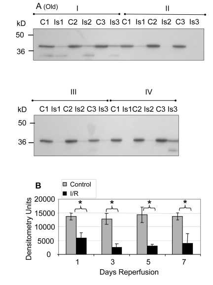 GAPDH pool levels in plantaris/FHL lysate from old mice