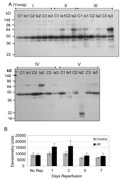 Western blot analysis of total tyrosine nitration of plantaris/FHL lysate from young mice following I/R