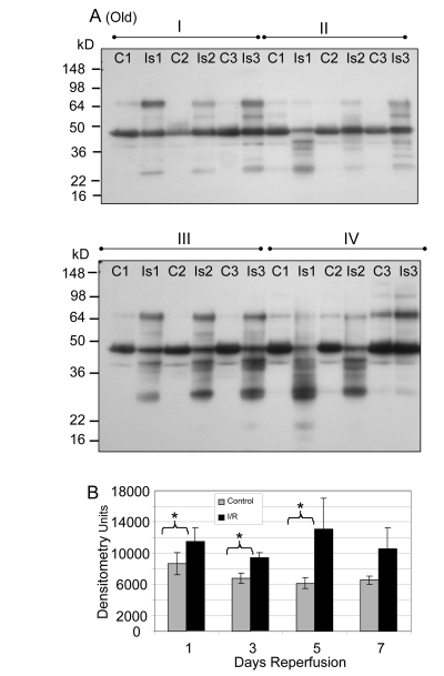 Western blot analysis of total tyrosine nitration of plantaris/FHL lysate from old mice following I/R