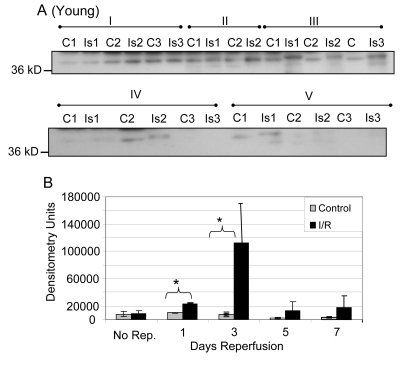 Tyrosine nitration of GAPDH in plantaris/FHL lysate from young mice