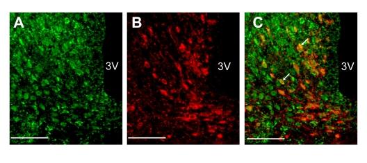 Localization of insulin receptors in NPY neurons in ARC