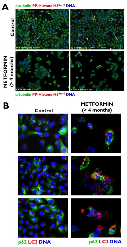 Chronic exposure to metformin suppresses the proliferative activity of human [A431] cancer cells (A) to enter a form of permanent cell-cycle arrest accompanied by the induction of “self-digesting” autophagy (B).