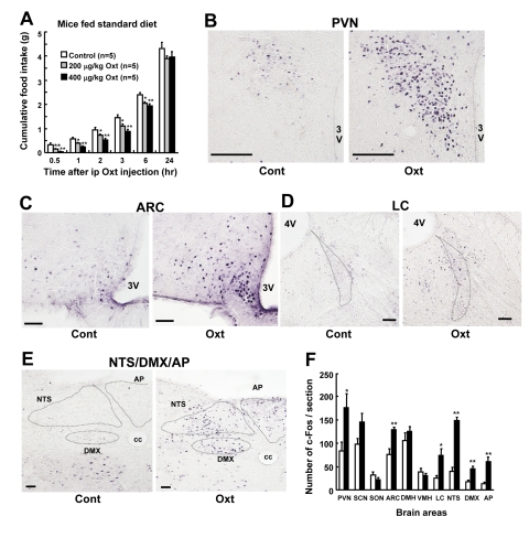 Ip injection of Oxt suppresses food intake and activates neurons in the hypothalamus and brain stem in standard diet fed mice