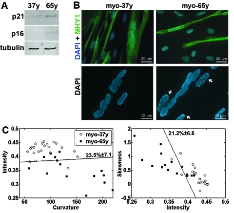 Cell classification in myoblasts from young and old donors