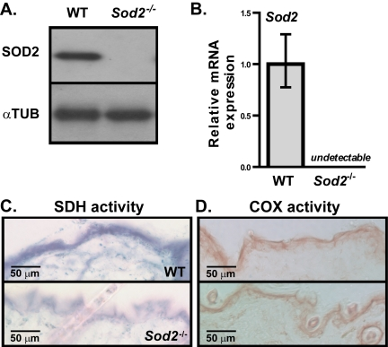 Sod2 expression and mitochondrial activity in skin of WT and Sod2−/− mice