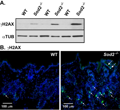 DNA damage in WT and Sod2−/− mouse skin