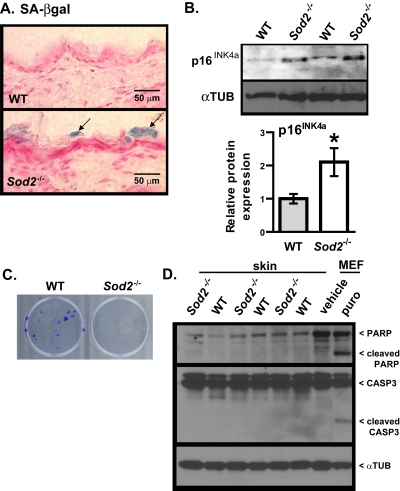Cellular senescence in skin of WT and Sod2−/− mice
