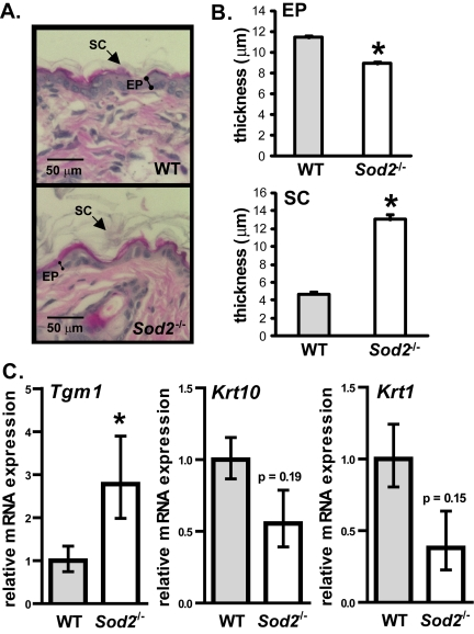 Epidermal thinning in Sod2−/− mice