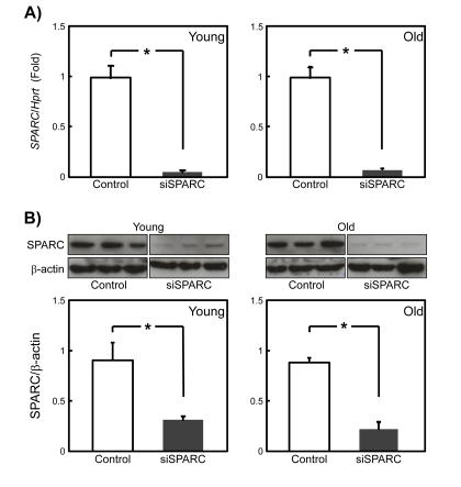 Inhibition of SPARC expression by RNA silen-cing in young and old rat SMPCs
