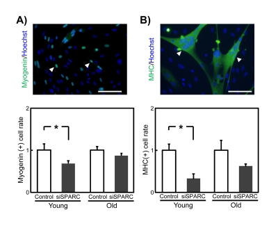 Effects of siSPARC on the myogenic potential of SMPCs