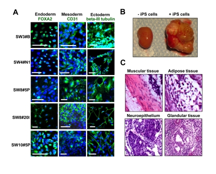 Pluripotency of HK-derived iPS cells verified through spontaneous differentiation in vitro and in vivo