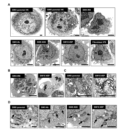 Morphological variations of patient-derived iPS cells upon reprogramming