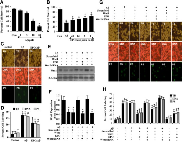EPO preserves microglia survival against Aβ through Wnt1
