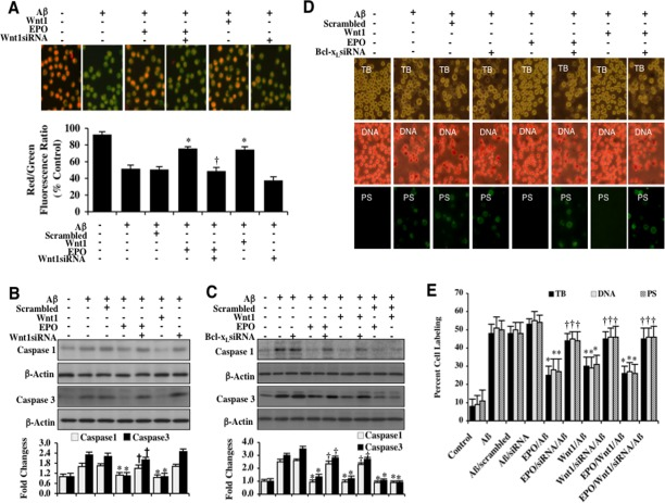 EPO and Wnt1 control mitochondrial membrane potential, block early and late apoptotic microglial Aβdegeneration, and prevent caspase 1 and 3 activation through Bcl-xL