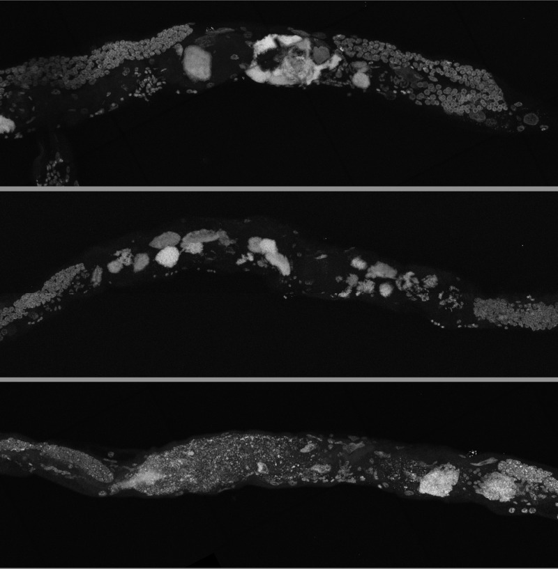 Germline masses in worms grown in axenic media