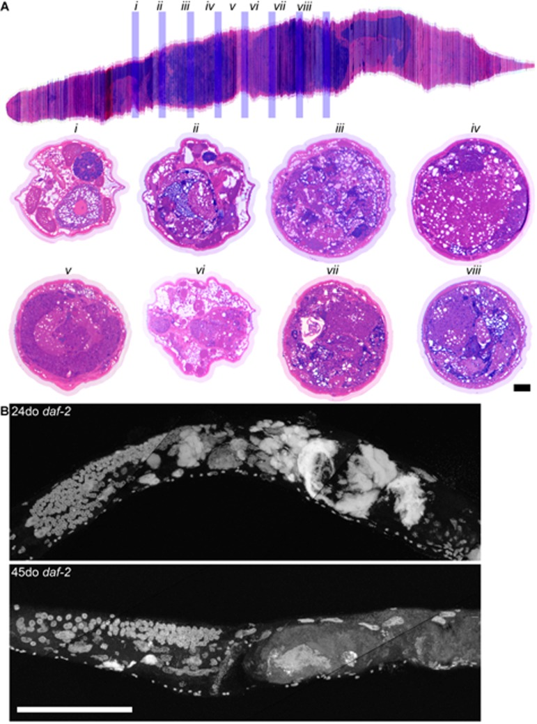 Long-lived daf-2 mutants have decreased uterine masses with age